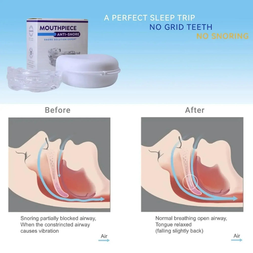 Vespira SilentSleep™ Anti-Snoring Mouthpiece