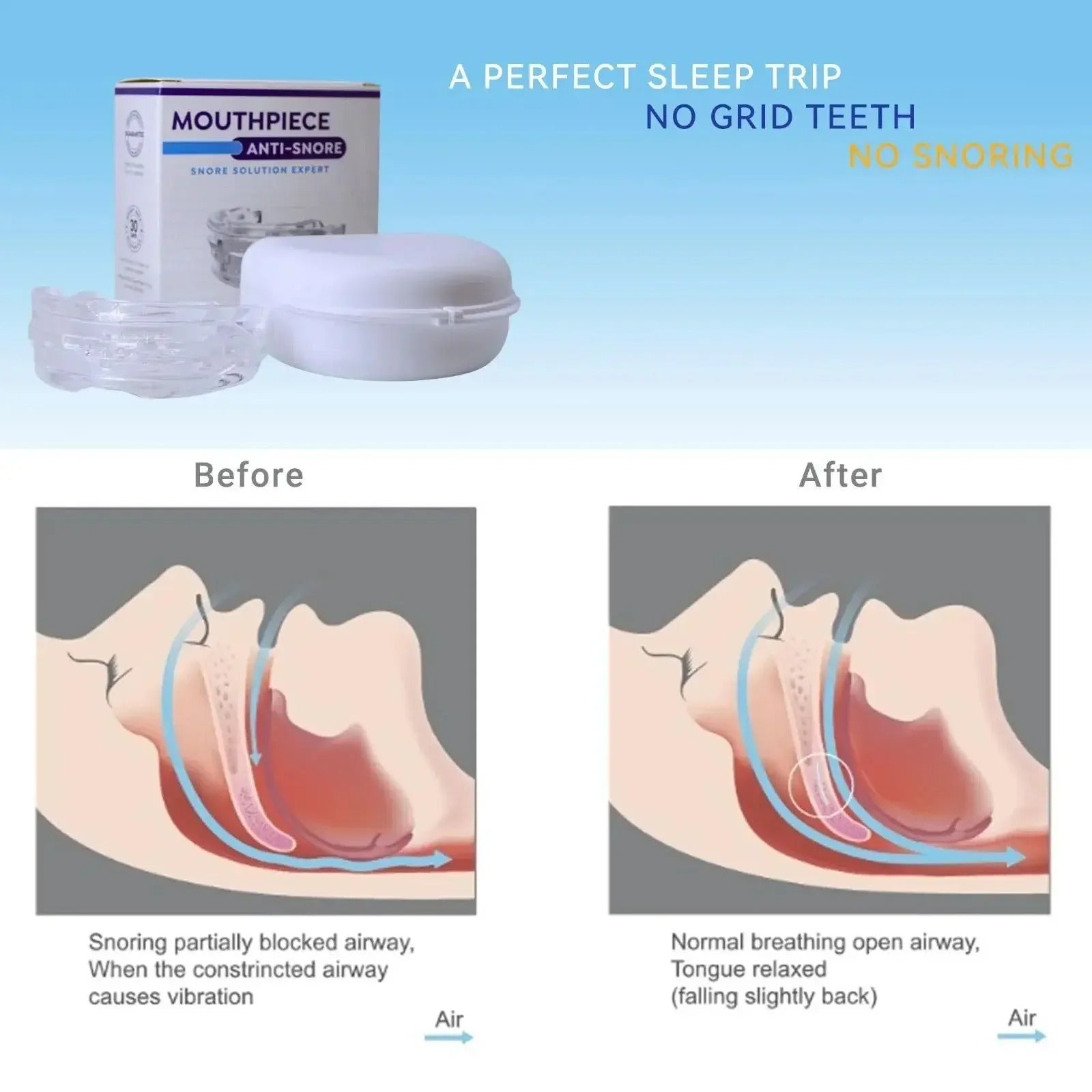 Vespira SilentSleep™ Anti-Snoring Mouthpiece